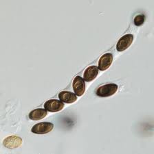 <p>sac-like sporangium</p>