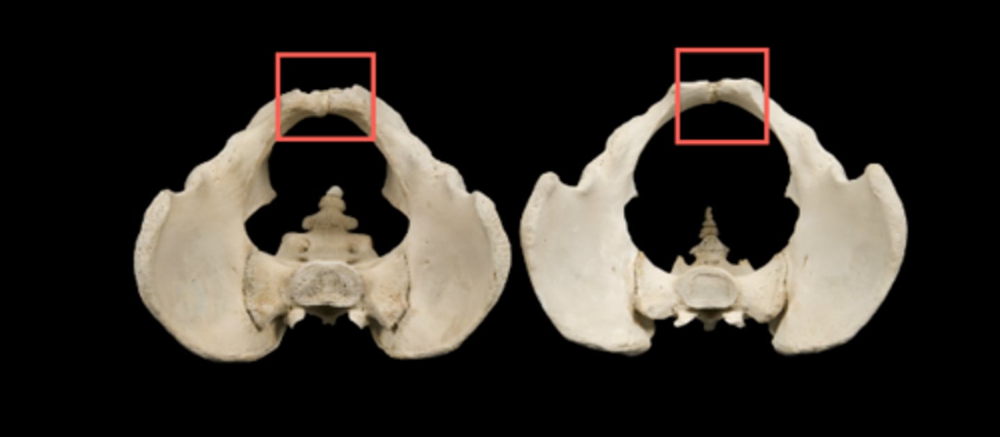 <p>bumps on front of pubis. crest is MEDIAL</p>