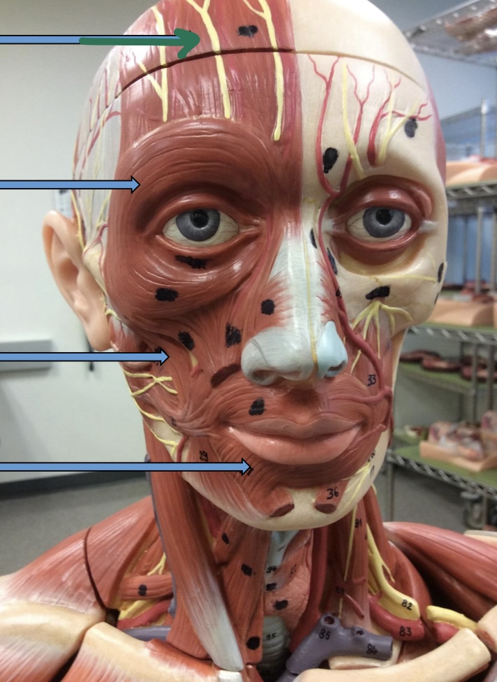 <p>Identify this muscle?</p>