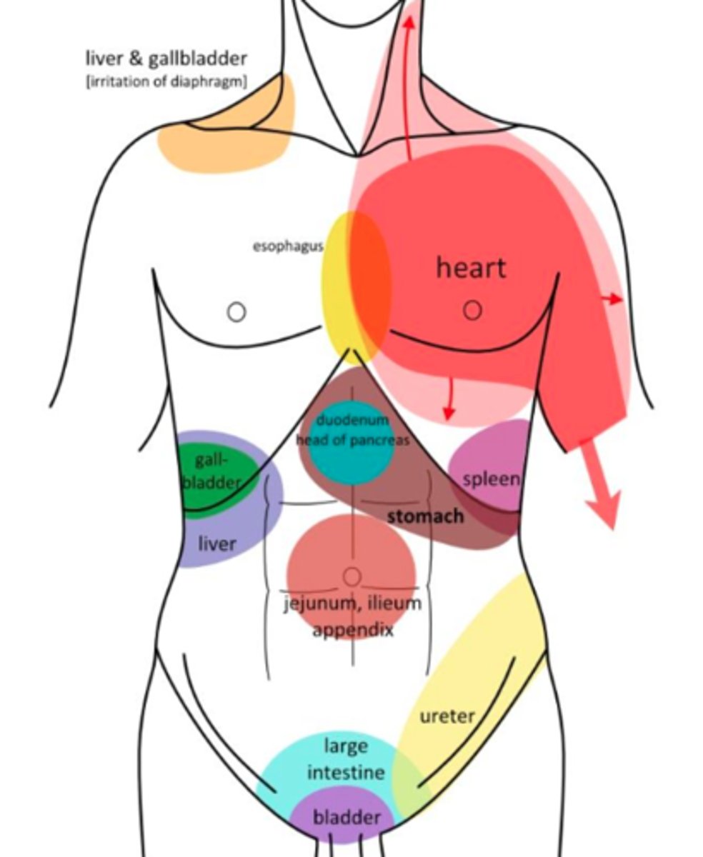 <p>-pain felt in one part of body is caused by pain in another part</p><p>-pain originates in uterus, but client might feel in abdominal wall, lower back, hips, buttocks, thighs</p>