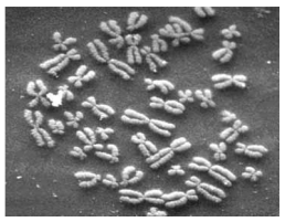 <ul><li><p>chromatin is lower order of DNA organization whereas chromosomes are higher order of DNA organization</p></li><li><p>before cell division, chromatin forms itself into chromosomes</p></li></ul>