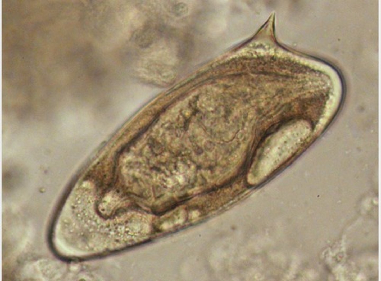 <p>Blood fluke most commonly found in Africa, South America, West Indies and Porto Rico.</p><p>Lives in the large intestines.</p><p>Approximately 115-175 micrometers by 45-75 micrometers.</p><p>Lateral spine.</p>