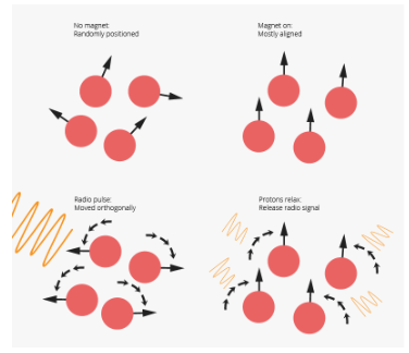 <p>Based on the principle that hydrogen atoms behave like spinning bar magnets in the presence of a magnetic field.</p><ul><li><p>Areas with high water (H2O) content (cell-body rich areas) stand out from areas with low water content (axons).</p><ul><li><p>white matter has less density of H2O so it appears differently from grey matter in the MRI.</p></li></ul></li></ul><p></p>