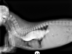 <p>What is this condition called? It can cause stenosis (stricture) of the esophagus</p>