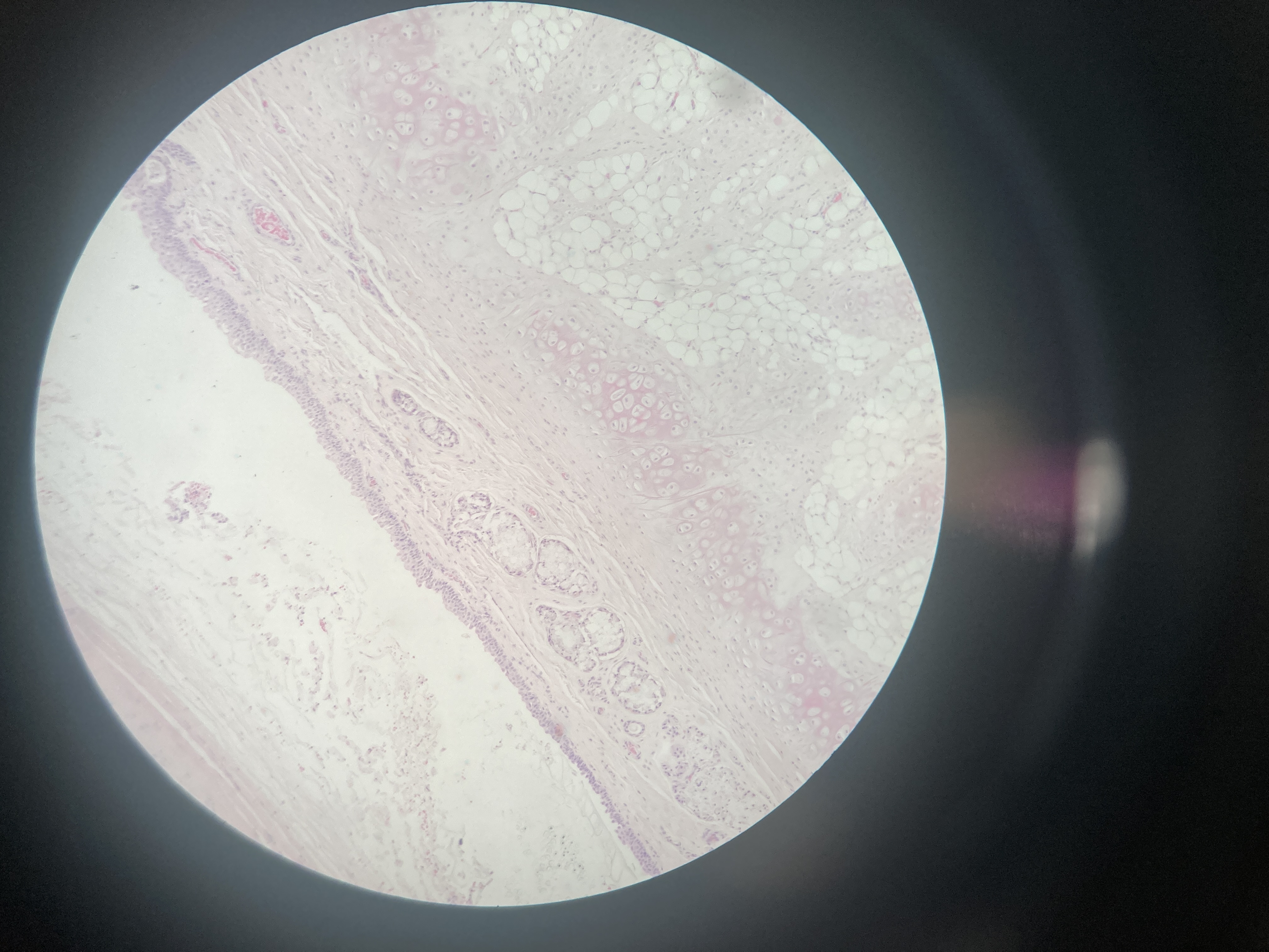 <p>Trachea (cat)</p><p><span>Pseudostratified ciliated columnar epithelial</span></p><p><span>Goblet cells</span></p><p><span>Basal cells</span></p><p><span>Brush cells</span></p><p><span>Submucosal glands</span></p><p><span>Smooth muscle cells</span></p><p><span>Cartilage</span></p>