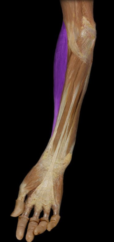 <p>Name the muscle highlighted (one word - all lowercase)</p>