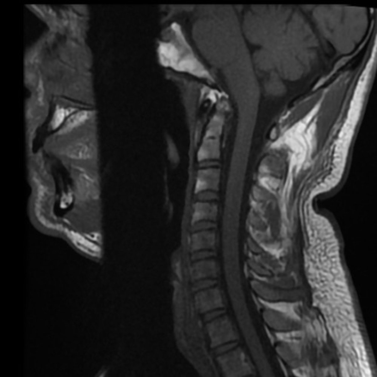 <p>What MRI sequence is this?</p>