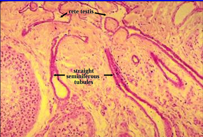 <p>Mediastinum testis. </p><p>Straight seminiferous tubules are seen connecting with the rete testis</p>