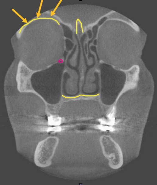 <p>what are the arrows pointing to </p>
