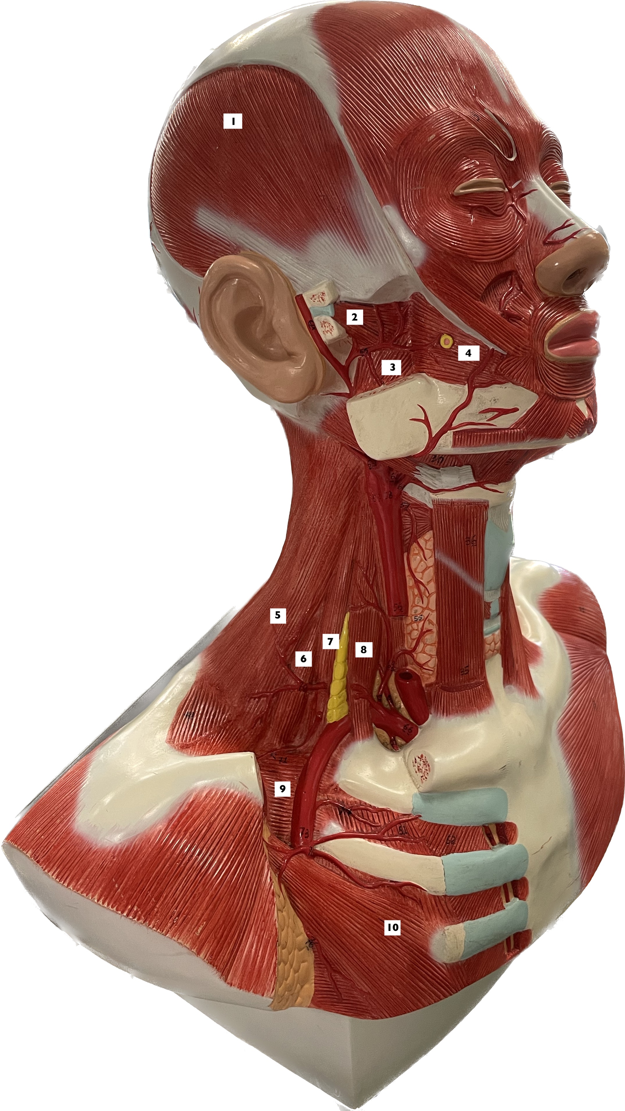 lateral pterygoid - protracts mandible