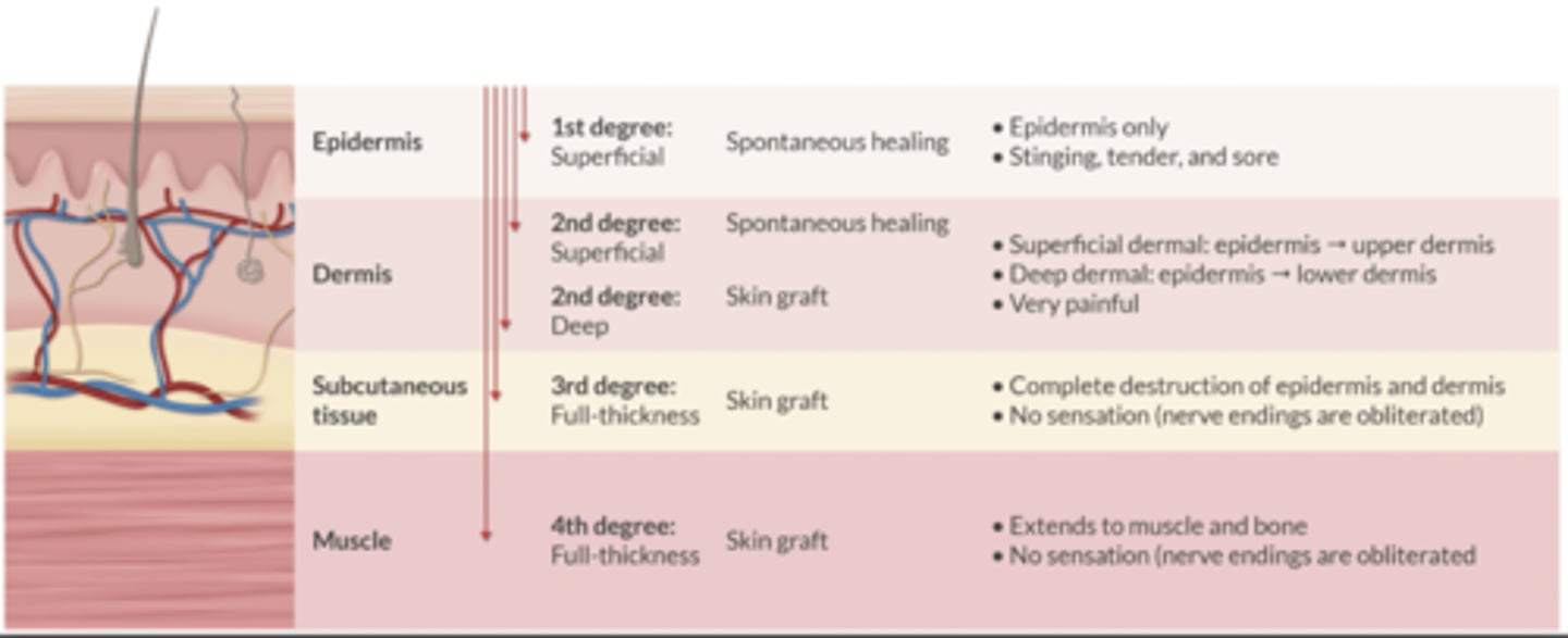 <p>1st Degree: superficial</p><p>-Spont healing</p><p>2nd Degree: superficial</p><p>-Spont healing</p><p>2nd Degree: deep</p><p>-Skin graft</p><p>3rd Degree: full-thickness</p><p>-Skin graft</p><p>4th Degree: Full-thickness</p><p>-Skin graft</p>