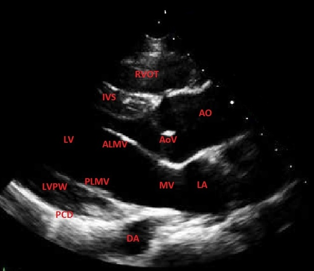 <p>What happens at the very end of the cardiac cycle, leading to the next cycle?</p>