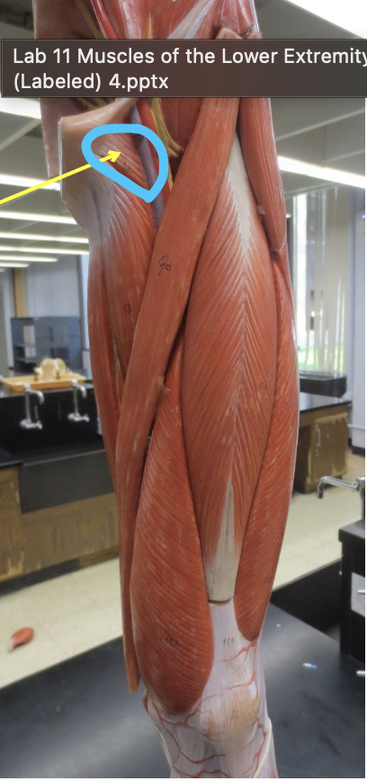 <p>Which muscle</p>