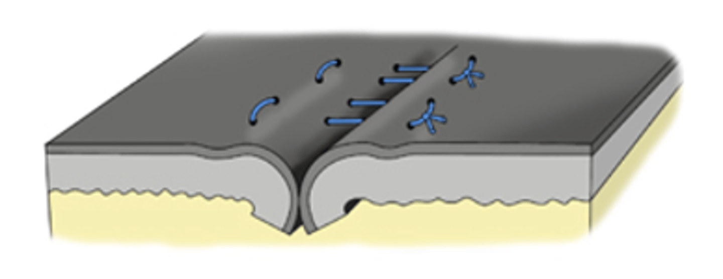 <p>- The edges of the incision roll inwards.</p>