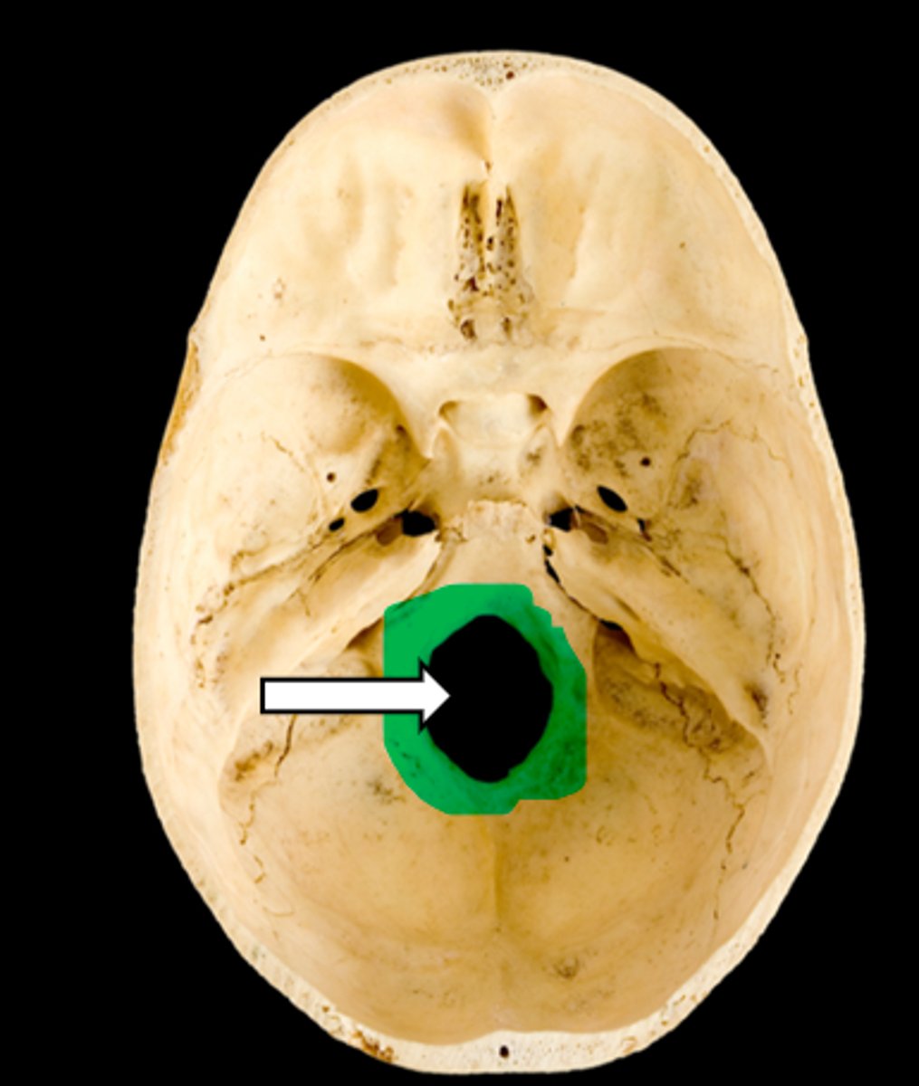 <p>name the part</p>