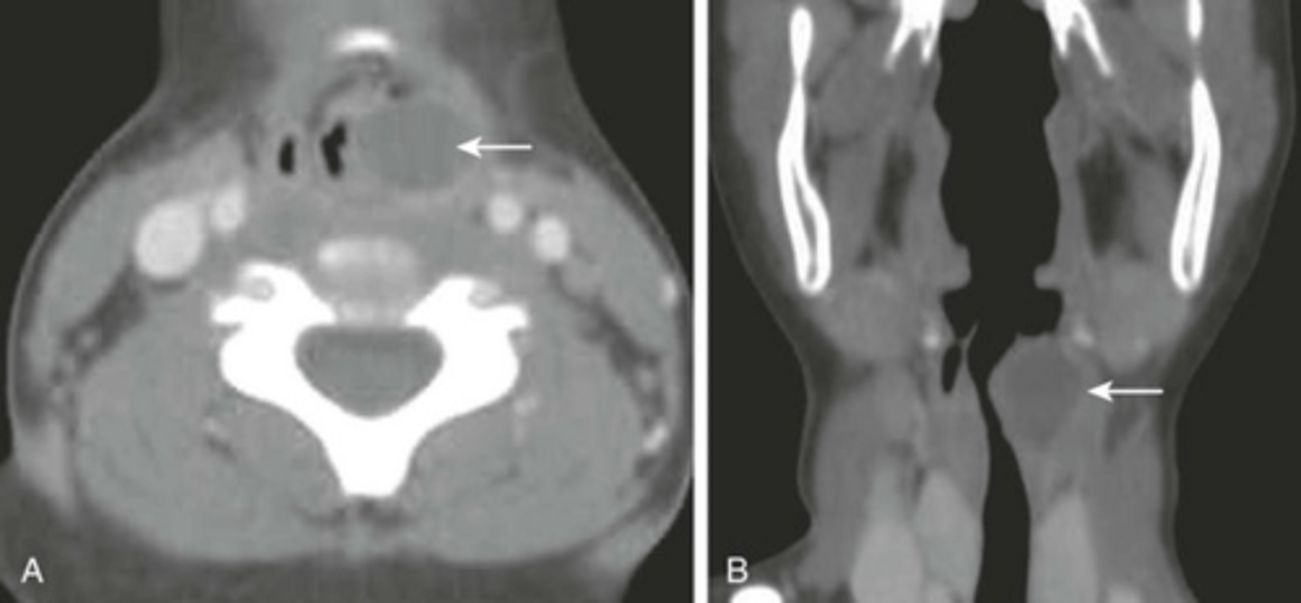 <p>Label pathology in the two images below</p>