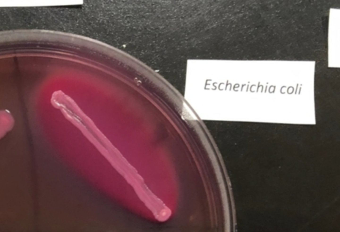 <p>E.coli</p>