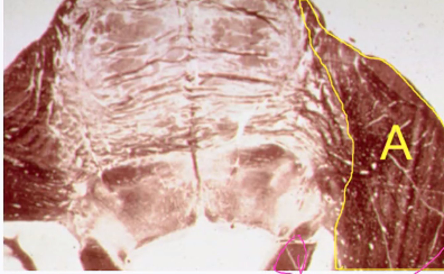 <p>Identify the structures indicated by the pink outline</p>