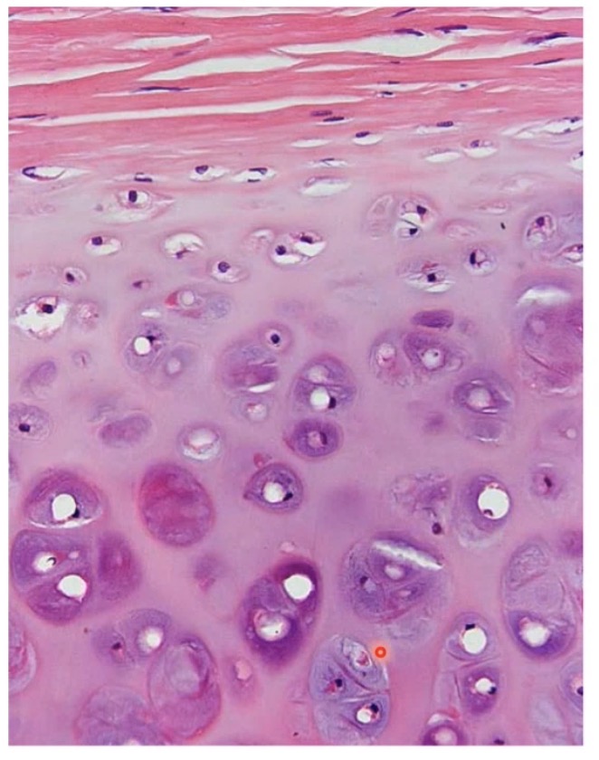 <ul><li><p>Antkremzlyje - chondroblastai</p></li><li><p>Zemiau ankremzlio - chrondocitai, kurie yra nedideli, pradeda formuoti izogenines grupes</p></li><li><p>Viduje kremzles jau susidaro dideles izogenines chondrocitu grupes, chondrocitai pasiekia savo augimo maksimuma</p></li></ul><p></p>