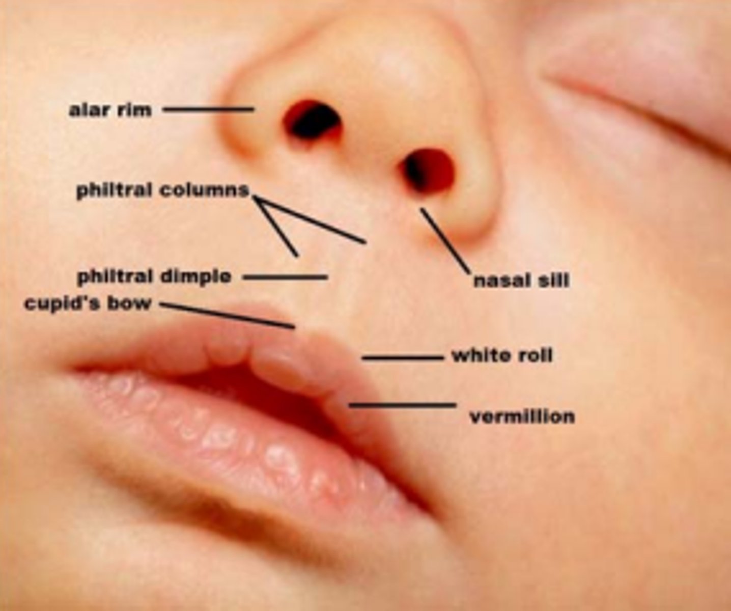 <p>base of the nostril opening (below the nasal ala)</p>