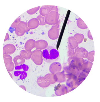 <p>what kind of white blood cells is this?</p>