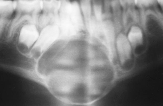 <p>Usually expansible </p>