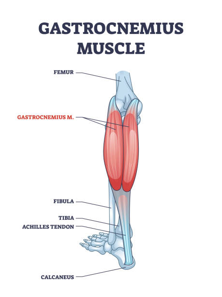 <p>Gastrocnemius</p>