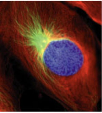 <p>what stage of mitosis?</p>