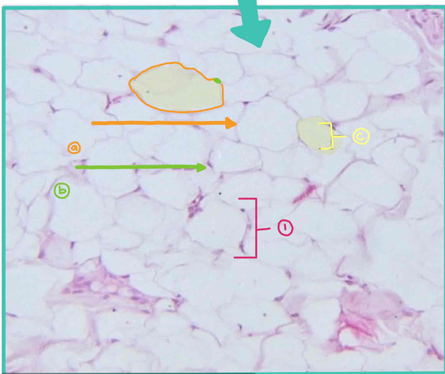 <ol><li><p>Preponderant Cell:</p><p>a.</p><p>b.</p><p>c.</p></li><li><p>Preponderant Fiber:</p></li></ol>