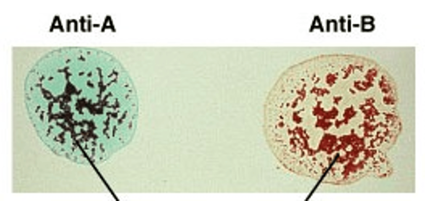 <p>What blood type is shown?</p>