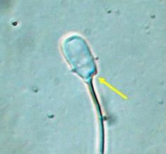 <p>Identify the sperm morphology.</p>