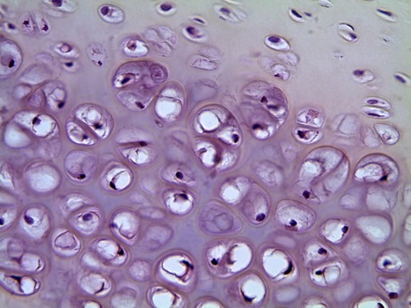<p>Chondrocyte and parts of: cytoplasm, nucleus</p><p>Lacuna</p><p>Matrix</p><p>Ribs, nose, trachea</p>
