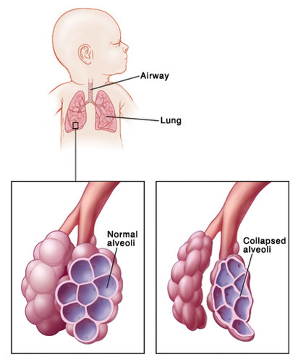 <p>chemical produced in the lungs to maintain the surface tension of the alveoli and keep them from collapsing</p>