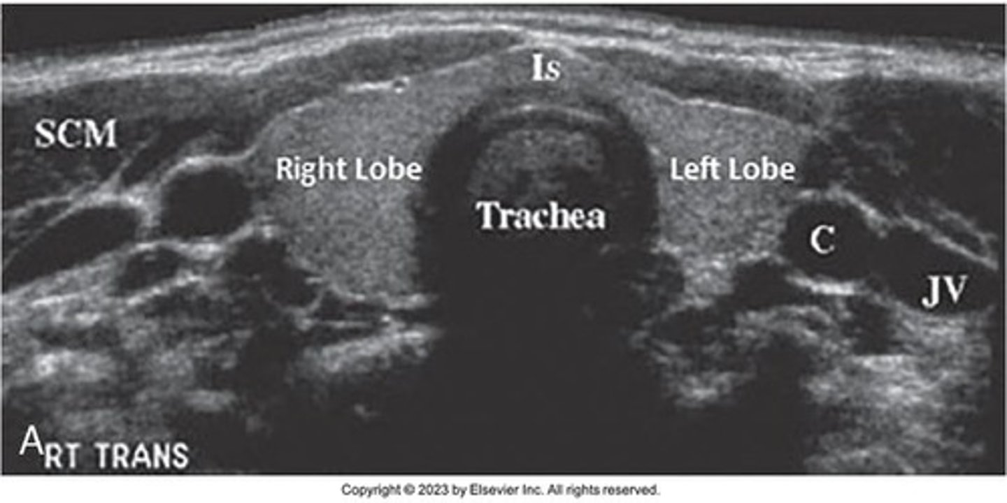 <p>Common carotid artery, internal jugular vein, and vagus nerve.</p>