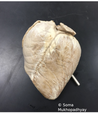 <p>Is this the anterior view or posterior view? </p>