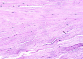 <ul><li><p><span style="background-color: transparent; font-family: "Book Antiqua", serif;"><span>Contains collagen fibers</span></span></p></li><li><p><span style="background-color: transparent; font-family: "Book Antiqua", serif;"><span>Found in pubis symphysis and intervertebral discs</span></span></p></li></ul><p></p>