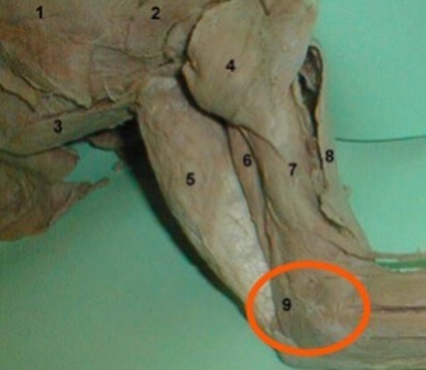 <p>Origin: Lateral Epicondyle of Humerus</p><p>Insertion: Olecranon</p>