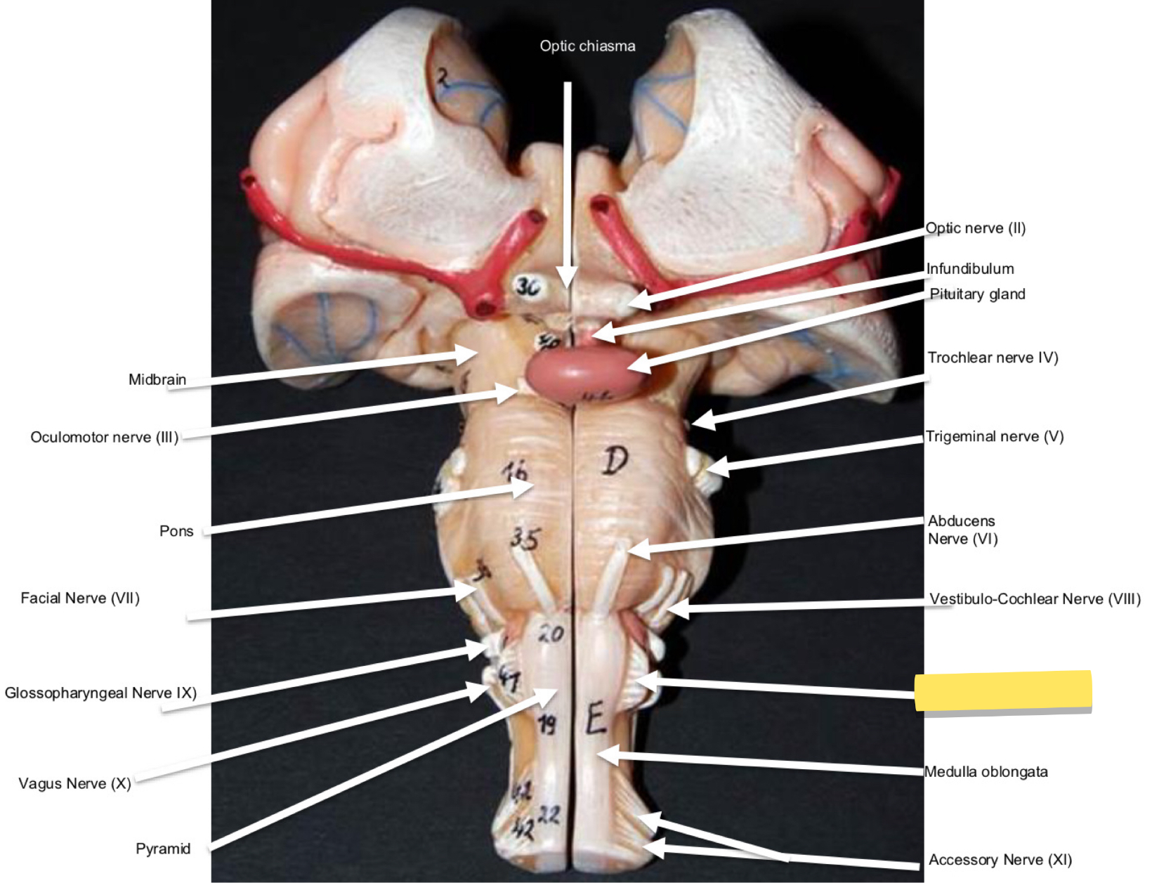 <p>Name this cranial nerve&nbsp;</p>
