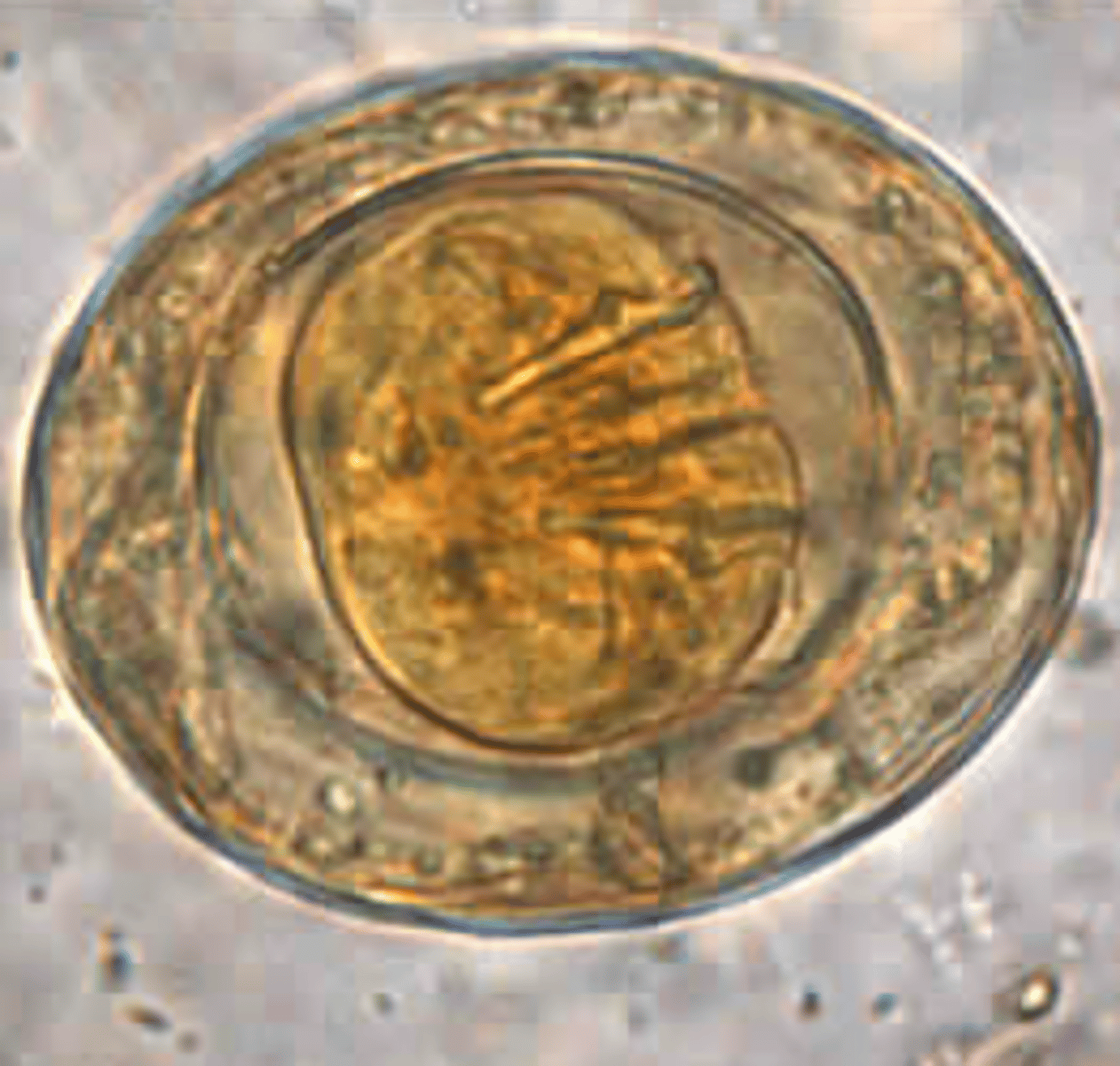 <p>• Eggs</p><p>o About 40 microns</p><p>o Two shells with polar filaments between</p><p>o Oncosphere has six hooklets</p>