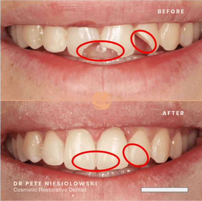 <p>Restorations</p>