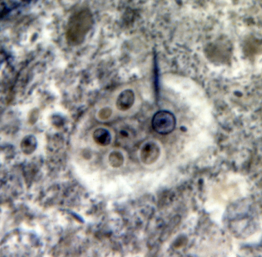 term image
