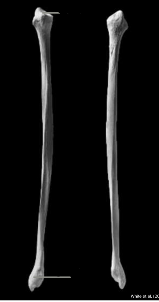 <p>Identify the lateral malleolus</p>