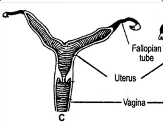 What type of uterus is this?