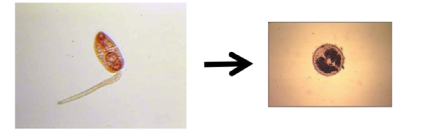 <p>-METACERCARIA (juvenile)</p><p>-Encysted form</p><p>a. in an intermediate host</p><p>-if has 2nd intermediate host)</p><p>b. on aquatic vegetation</p><p>-if has no 2nd intermediate host)</p><p>-must be ingested by vertebrate host.</p>