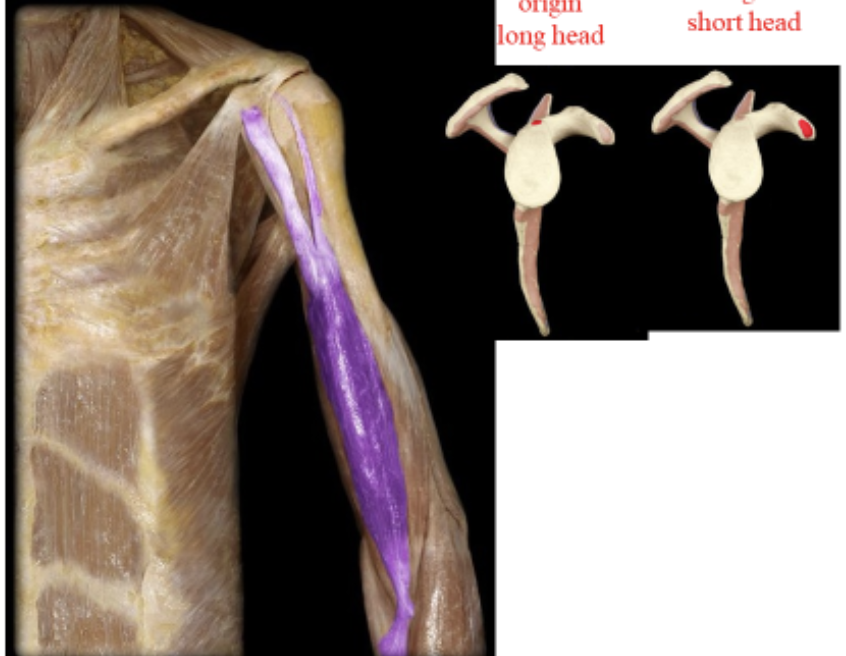 <p>large bi headed muscle on anterior surface of arm. Flexes the forearm, also supinates the hand.</p>