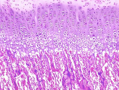 <ul><li><p>osteogeneza w nodze = kostnienie na podłożu chrzęstnym 13/105</p></li><li><p>chrząstka spoczynkowa - dosyć luźno</p></li><li><p>proliferacja - chrząstka proliferująca</p></li><li><p>kalcyfikacja - chrząstka hipertroficzna</p></li><li><p>strefa inwazji naczyń krwionośnych </p></li><li><p>kostnienie - wtórne blaszki kostne</p></li></ul><p></p>