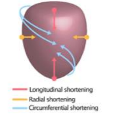 <p>Refers to the shortening or the lengthening of the myocardium from the base to apex.</p>