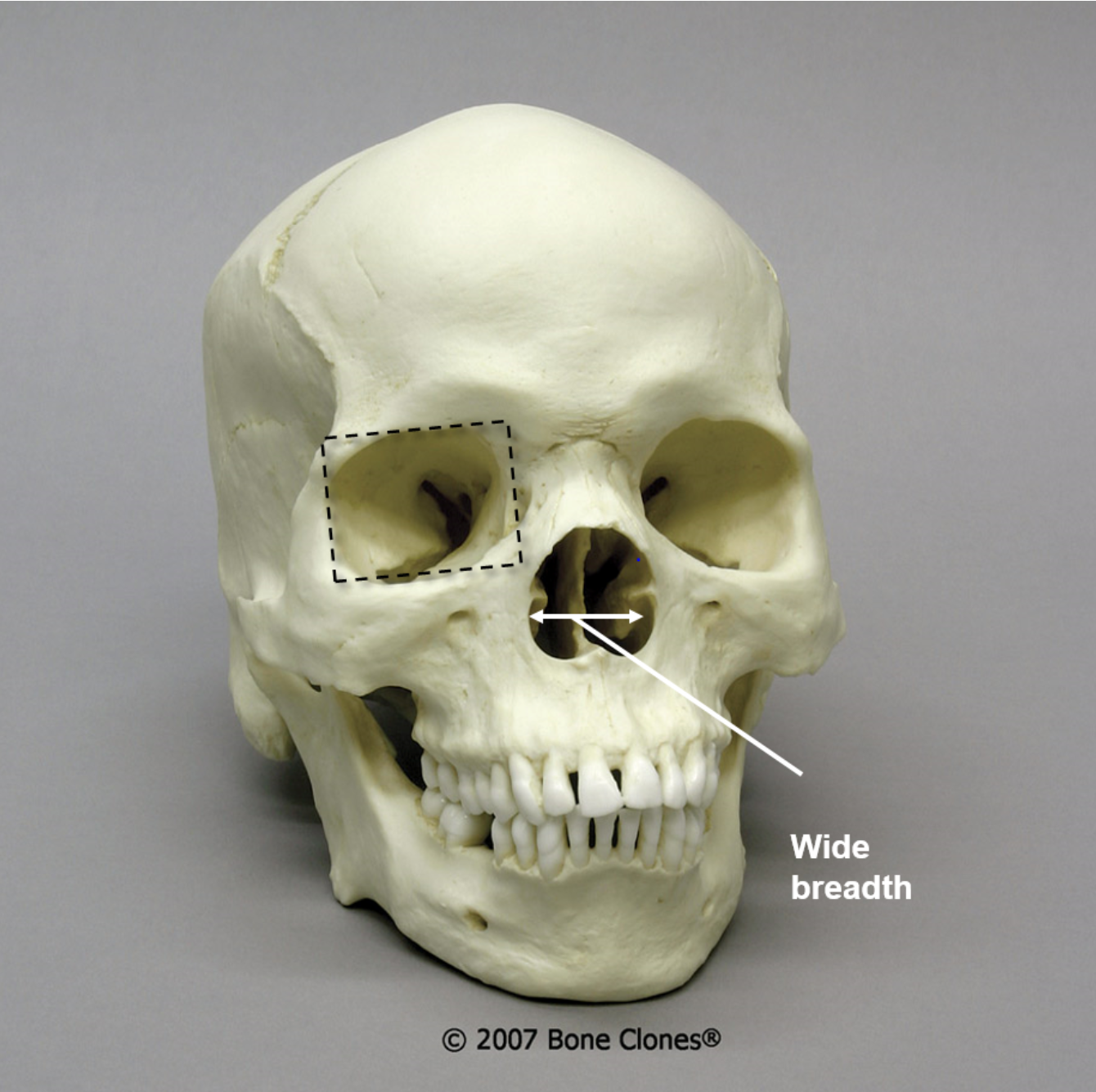<p>What is the ancestry of this skull?</p>