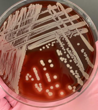<p>if you catalase is (+) and the gram stain shows GPC what next step would you take</p>