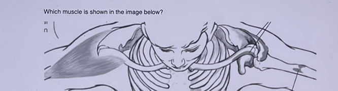Which muscle is shown in the image below? 